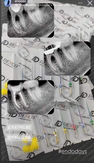 Limas Denco similares a BlueShaper 21mm Z1 (6 uds.) - Imagen 6