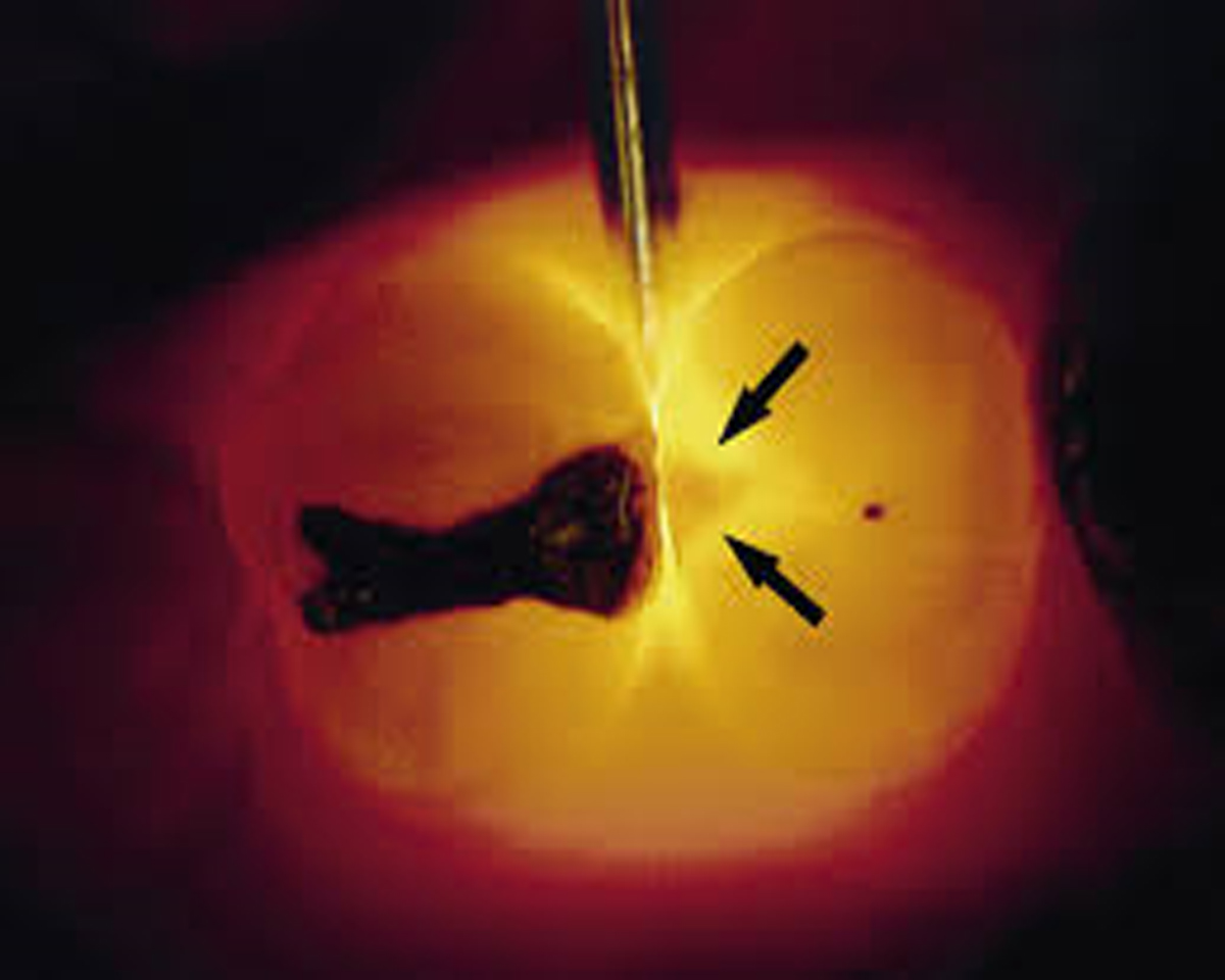 LAMPARA DE EXAMEN PARA DETECTAR FISURAS LUMINDEX 3 - Imagen 8