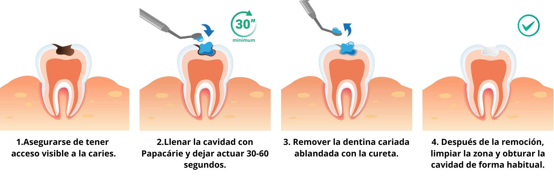 PAPACÁRIE DUO 3 ML - Imagen 12